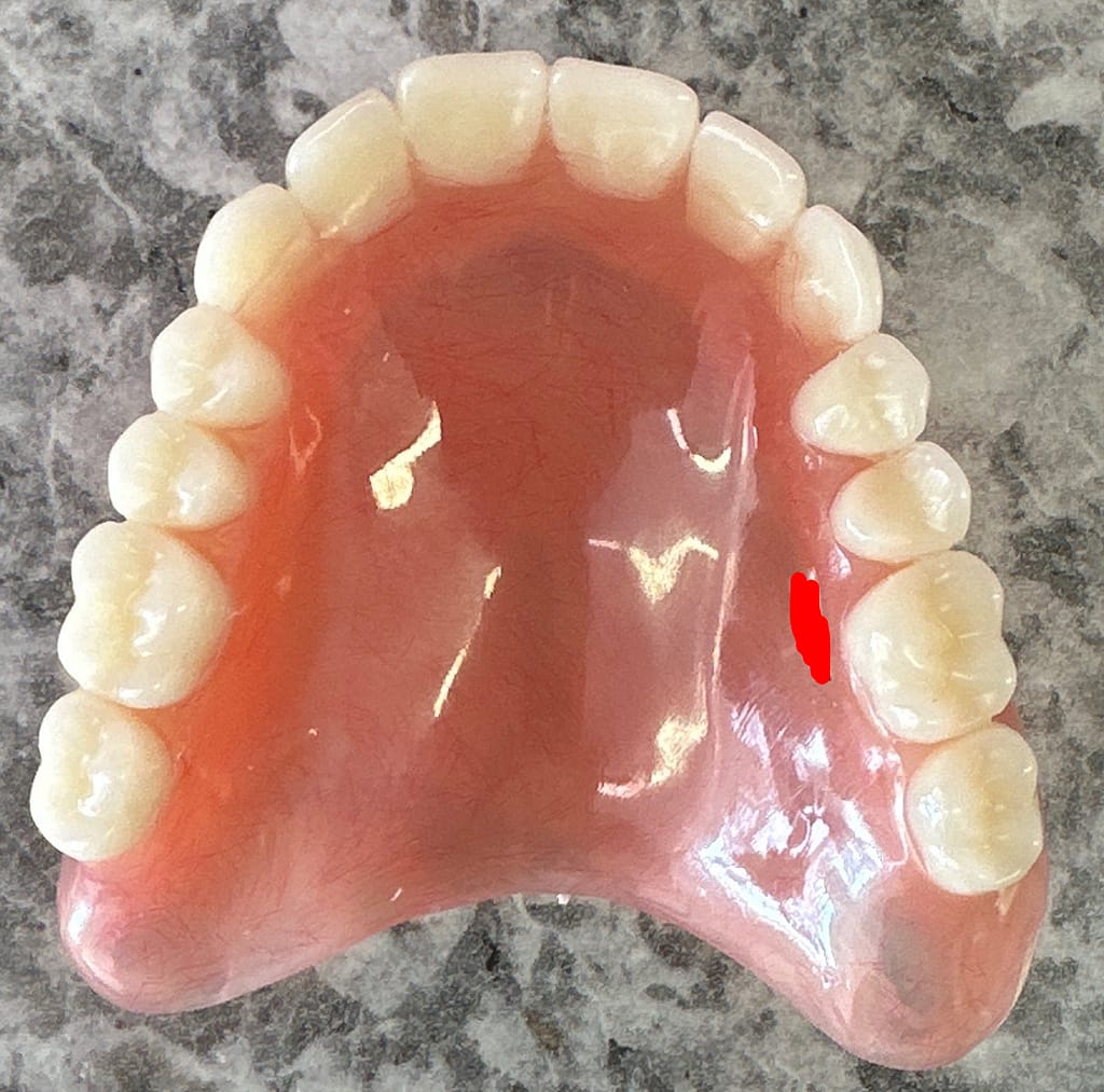 Image Gallery Buy Dentures Online!