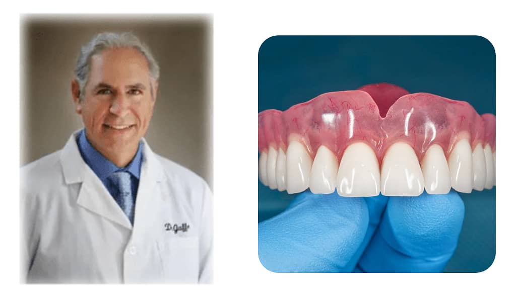 Simple Boil and Bite Dentures Get the Perfect Fit at Home