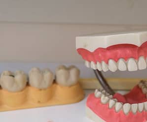 What to Expect for Your First Denture Procedure