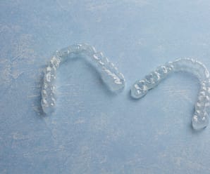 What Are Clear Aligners and How Do They Work?