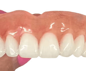 Are online dentures worth it?