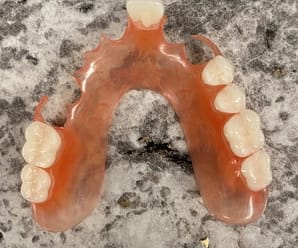 9 Important Considerations When Getting Partial Dentures
