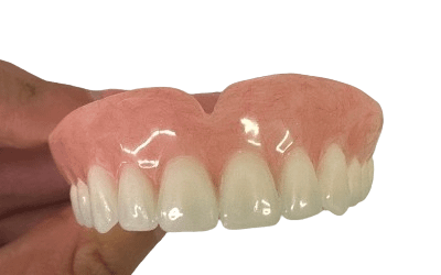Instructional Video: Learn How to Reline Upper Denture