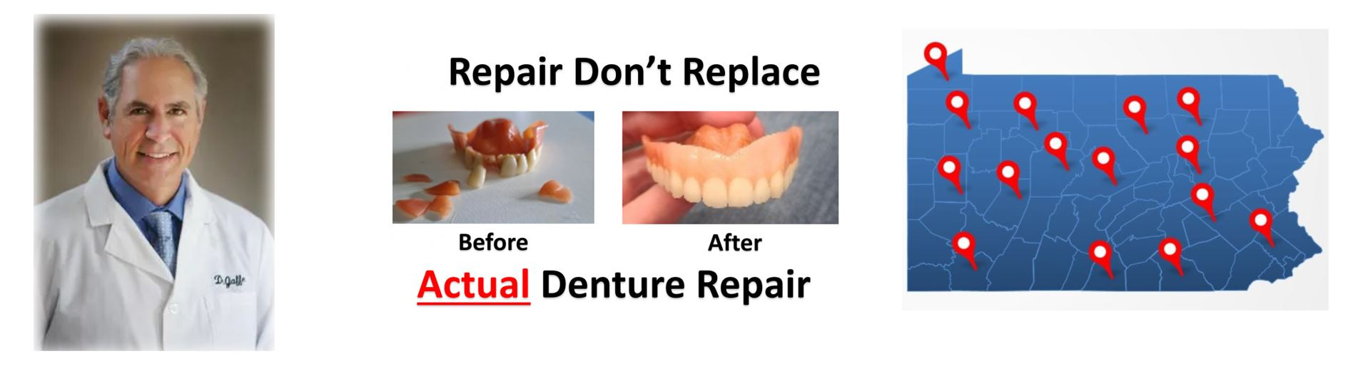 Broken Tooth Repair  Penn Dental Medicine