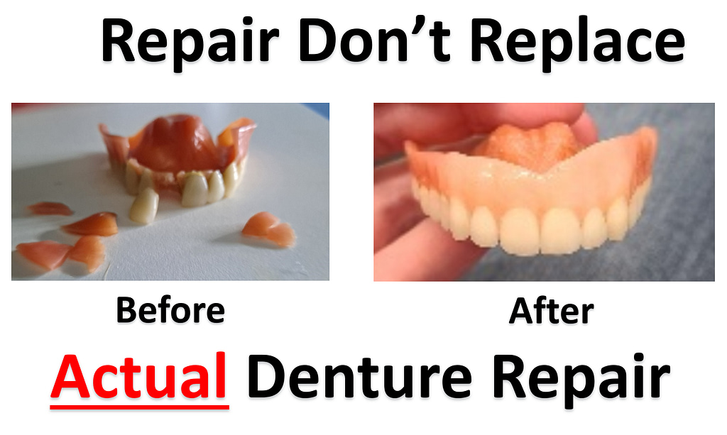 Akron Denture Repair Actual Repair