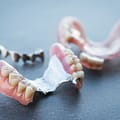 The Pros and Cons of Partial Dentures, Explained