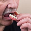 The Complete Guide to Adjusting to Dentures for New Wearers