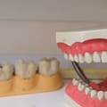 What to Expect for Your First Denture Procedure